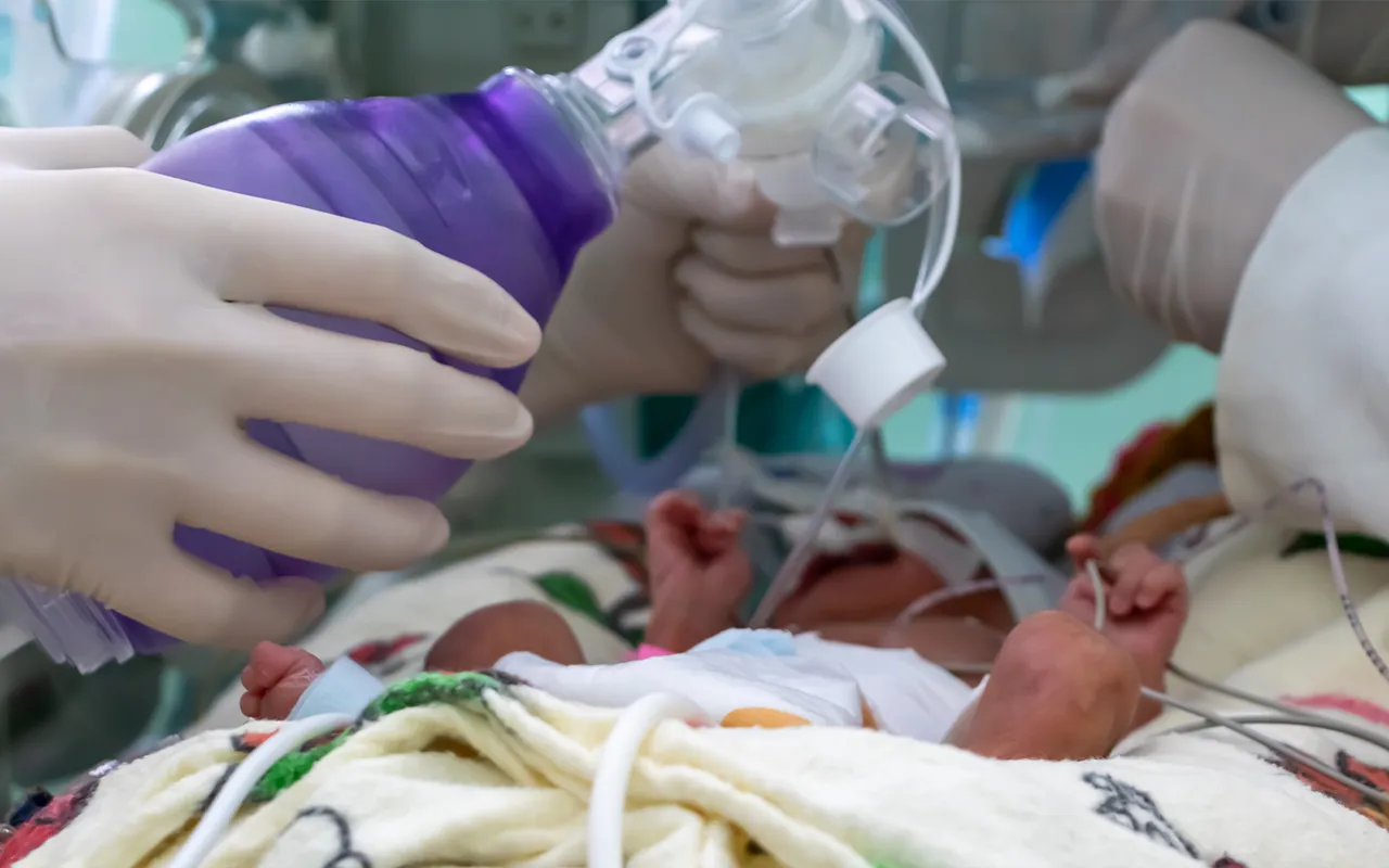 Módulo 10. Guías de práctica clínica para manejo de SDR en prematuros